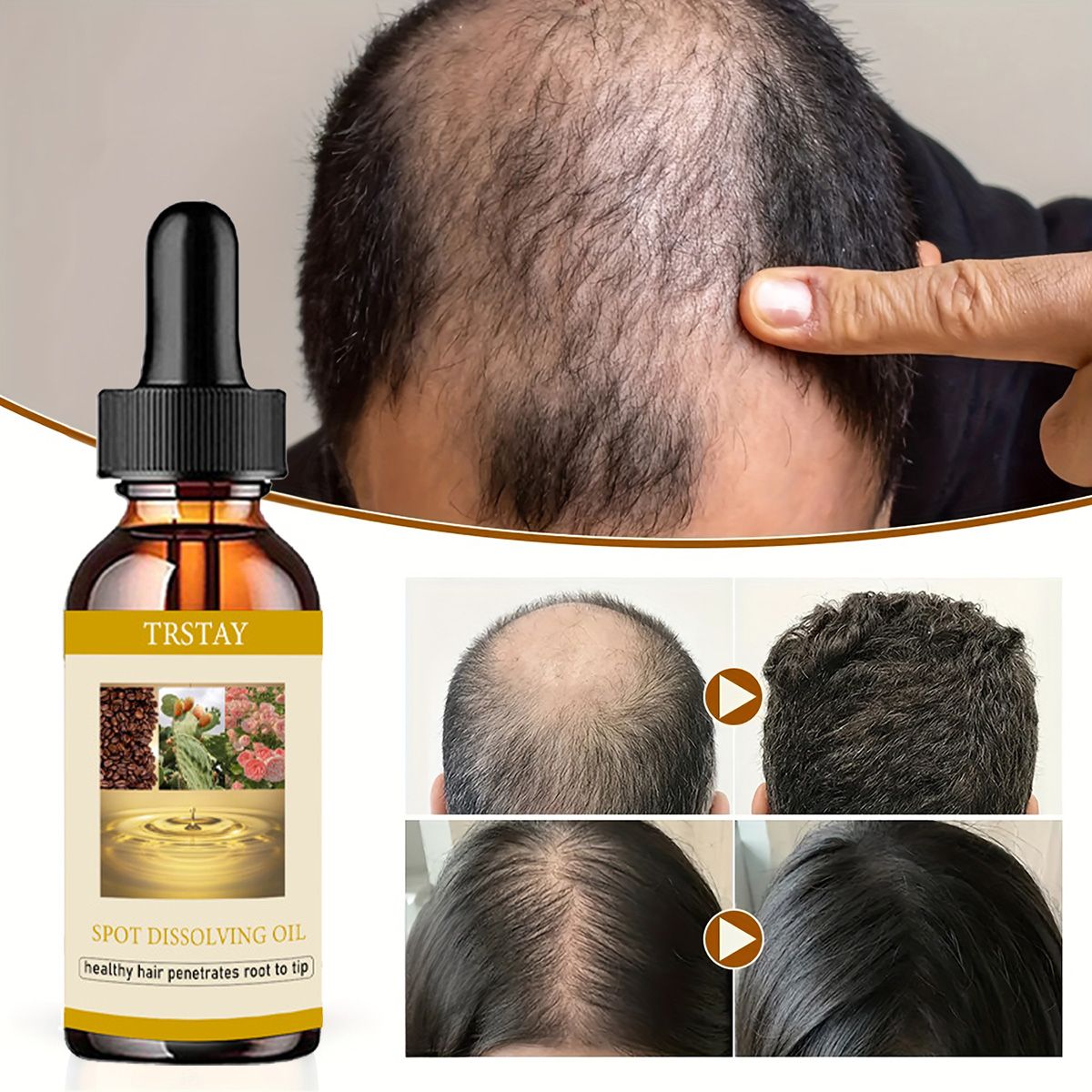 Beard Oil Growth - 50ML Beard Growth Oil Anti Alopecia