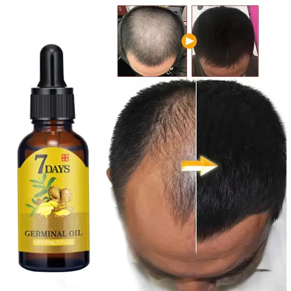 Beard Oil Growth - Hair Growth Ginger Fast Growing Hair