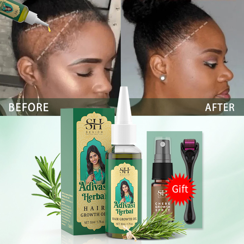 Ayurvedic Hair Growth Oil Indi - огляд і ціна Beard Oil Growth