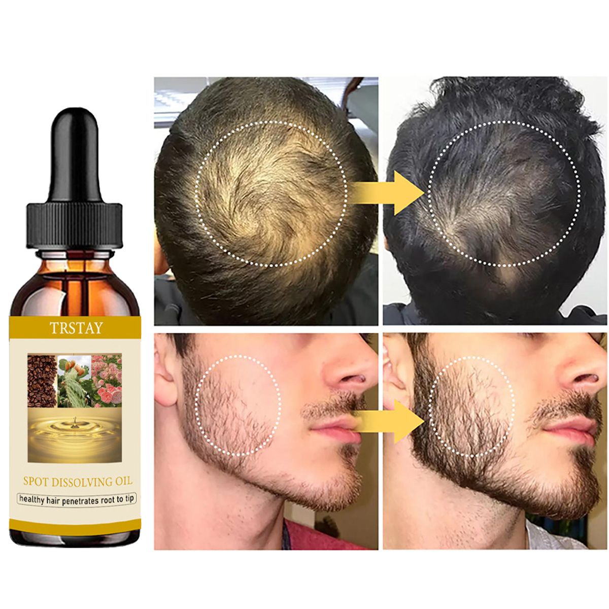 50ML Beard Growth Oil Anti Alo - огляд і ціна Beard Oil Growth
