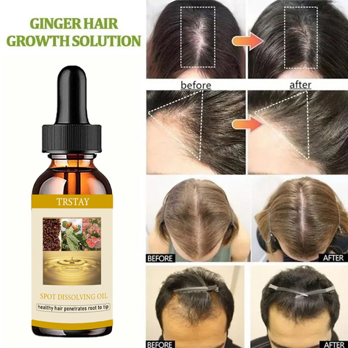 50ML Beard Growth Oil Anti Alo - огляд і ціна Beard Oil Growth