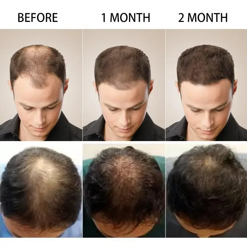 Hair Growth Ginger Fast Growin - огляд і ціна Beard Oil Growth